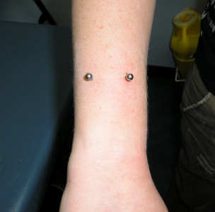 Surface piercing